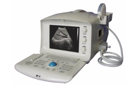 超声诊断系统 超声诊断系统