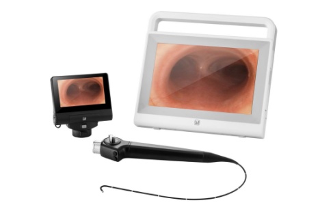 电子鼻咽喉镜 电子鼻咽喉镜