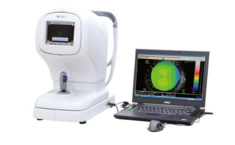 角膜地形图 角膜地形图