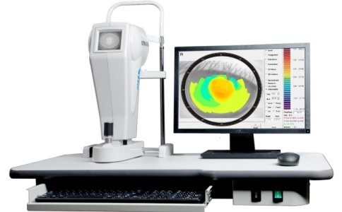 角膜地形图 角膜地形图
