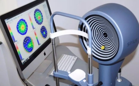 角膜地形图 角膜地形图