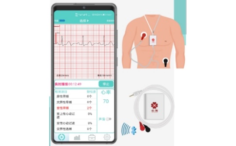 动态心电 动态心电