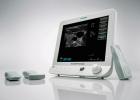 掌上超声诊断仪：价格、功率、厂家与品牌排行详解