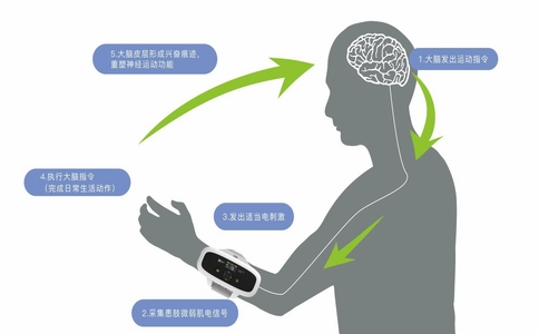 2025-02-14_神经康复治疗仪_5.jpg 2025-02-14_神经康复治疗仪_5.jpg