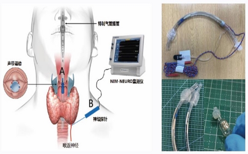20250226_喉返神经监测仪_20250226_131144_9912.jpg 20250226_喉返神经监测仪_20250226_131144_9912.jpg