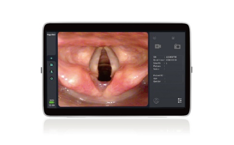 内窥镜图像处理器 内窥镜图像处理器