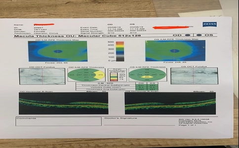 20250228_眼科设备单A超_20250228_133251_1825.jpg 20250228_眼科设备单A超_20250228_133251_1825.jpg