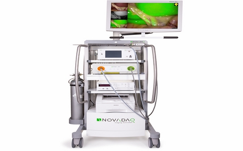 20250319_荧光内窥镜品牌_20250319_130748_5796.jpg 20250319_荧光内窥镜品牌_20250319_130748_5796.jpg