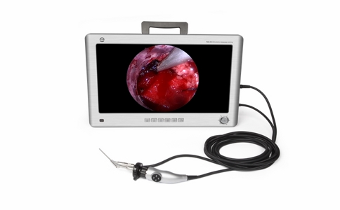 20250326_医用内窥镜_20250326_134130_1626.jpg 20250326_医用内窥镜_20250326_134130_1626.jpg