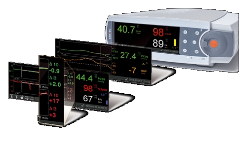 20250403_经皮二氧化碳分压监测仪_20250403_113944_2112 04-03-2025.jpg 20250403_经皮二氧化碳分压监测仪_20250403_113944_2112 04-03-2025.jpg