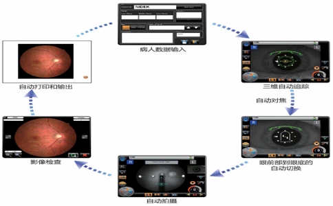 20250408_尼德克眼底照相机_20250408_130514_8714 04-08-2025.jpg 20250408_尼德克眼底照相机_20250408_130514_8714 04-08-2025.jpg