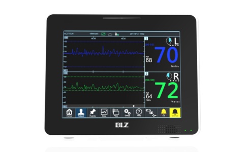 脑组织氧饱和度监测仪 脑组织氧饱和度监测仪