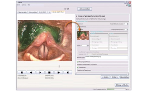 嗓音分析软件 嗓音分析软件