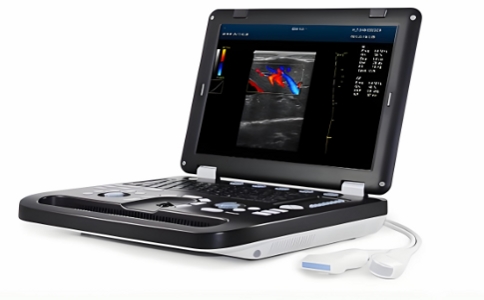 便携式彩超 06-19-2025.jpg 便携式彩超 06-19-2025.jpg