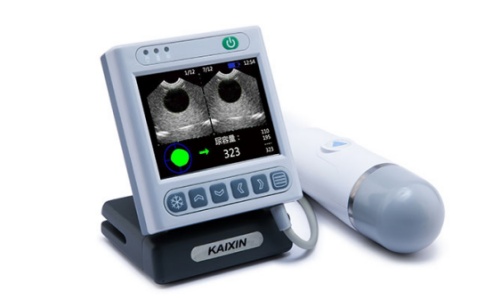 膀胱扫描仪 膀胱扫描仪