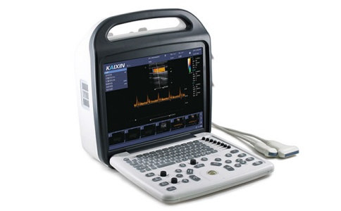 彩色多普勒超声诊断仪 彩色多普勒超声诊断仪