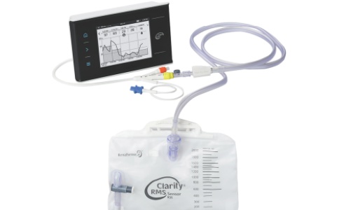 尿量监测仪 尿量监测仪