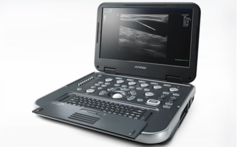 超声诊断系统 超声诊断系统