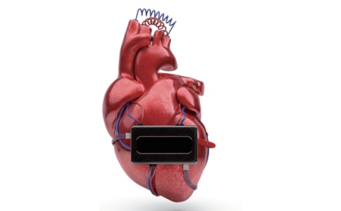 罗氏心脏标志物检测仪cobas h 232