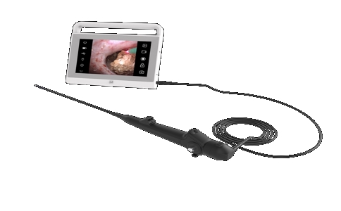 20250422_电子膀胱内窥镜_20250422_131454_1922.jpg 20250422_电子膀胱内窥镜_20250422_131454_1922.jpg