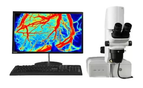 玉研激光散斑血流成像仪HR PRO