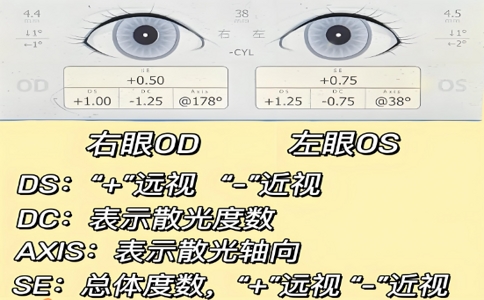 视力筛查仪 06-18-2025.jpg 视力筛查仪 06-18-2025.jpg