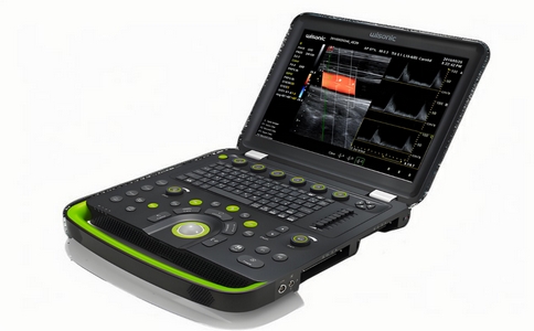 华声便携式彩超.jpg 华声便携式彩超.jpg