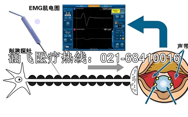 喉返神经监测仪3.jpg 喉返神经监测仪3.jpg