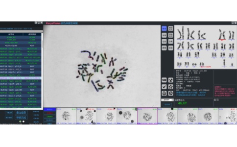 穗加染色体核型图像分析仪 KSA-800