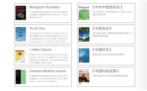 华佗耳迷走神经刺激仪 华佗耳迷走神经刺激仪