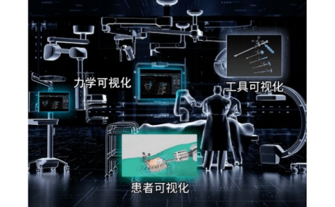 手术导航定位 手术导航定位
